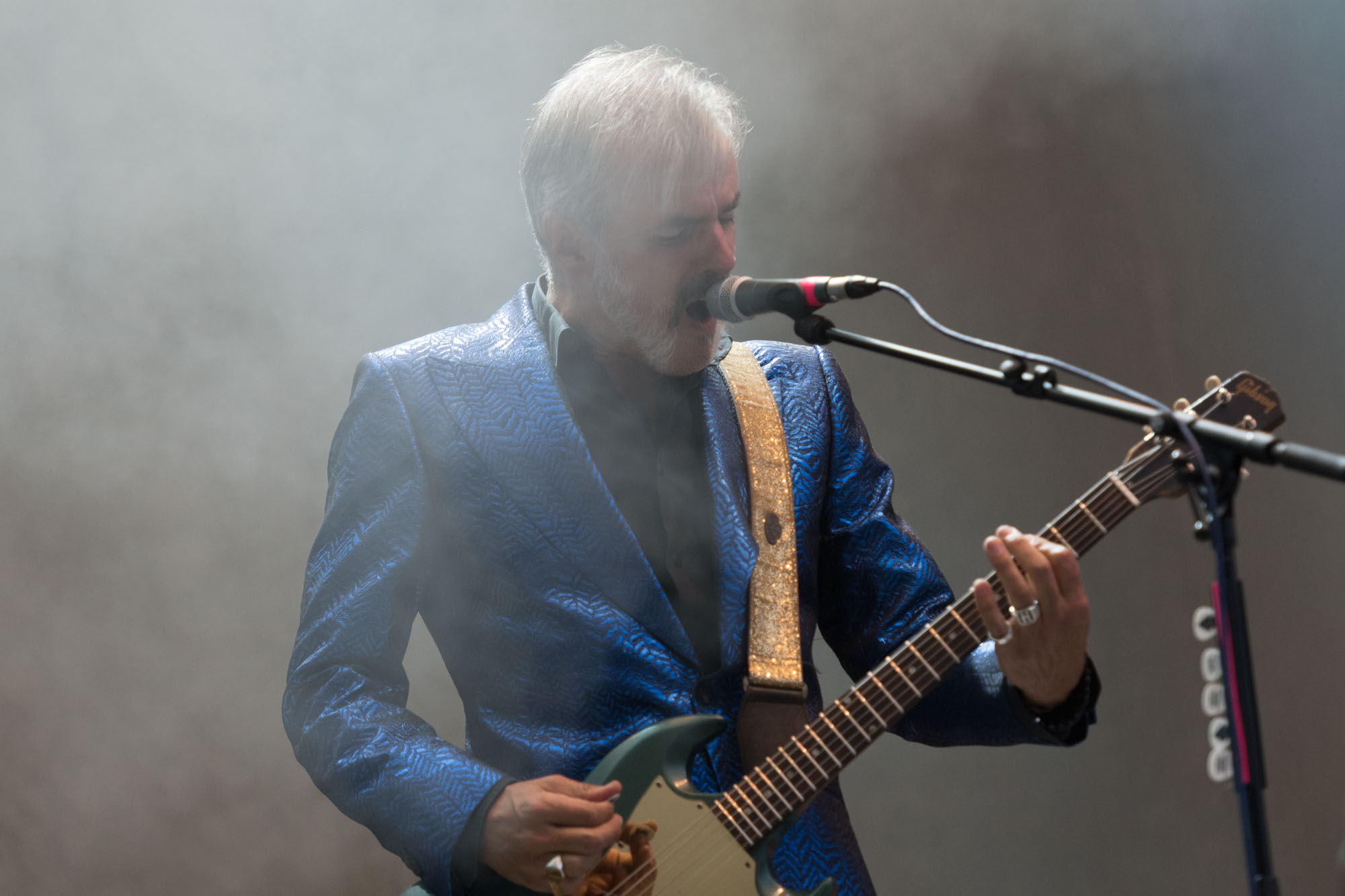 Triggerfinger